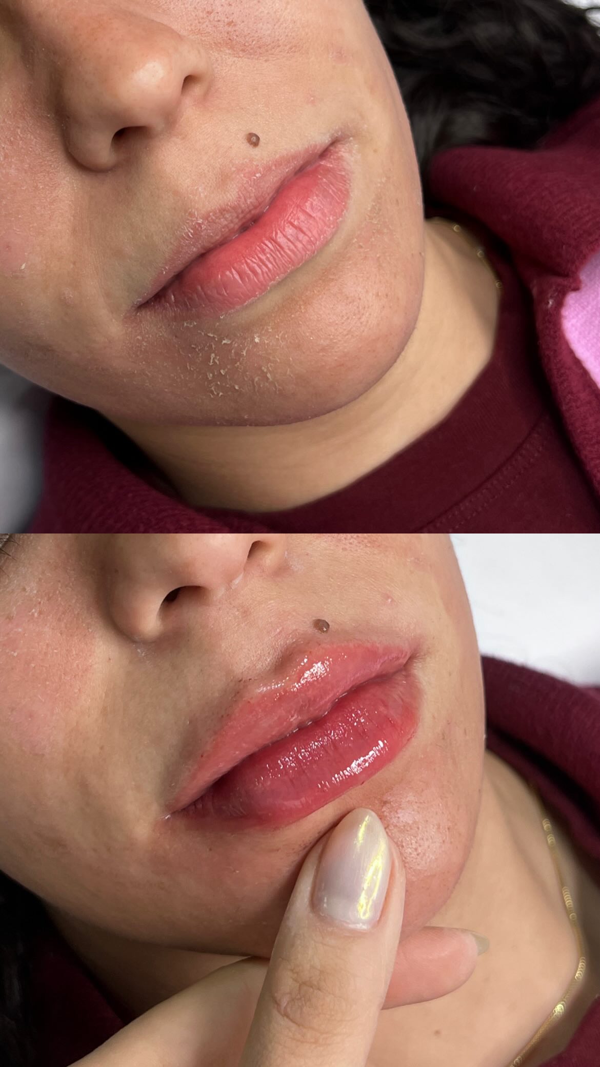 Cuidado labial